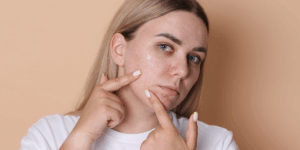  Best Cosmetic Scar Treatment in Thane