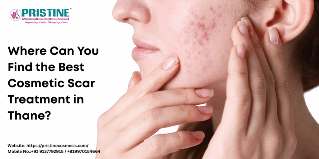 Where Can You Find the Best Cosmetic Scar Treatment in Thane?
