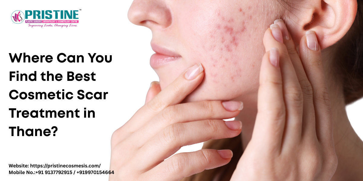 Where Can You Find the Best Cosmetic Scar Treatment in Thane?