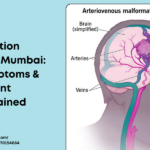 AV Malformation Treatment in Mumbai