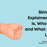 Skin Grafting in Thane