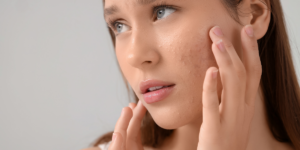Dermatologist in Thane 