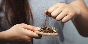 Hair-Transplant-Doctor-in-Thane