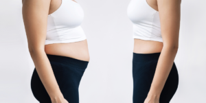 Fat Reduction Treatment in Thane 