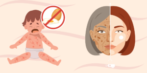 Expert Tips on Pediatric & Old Age Skin Care In Thane