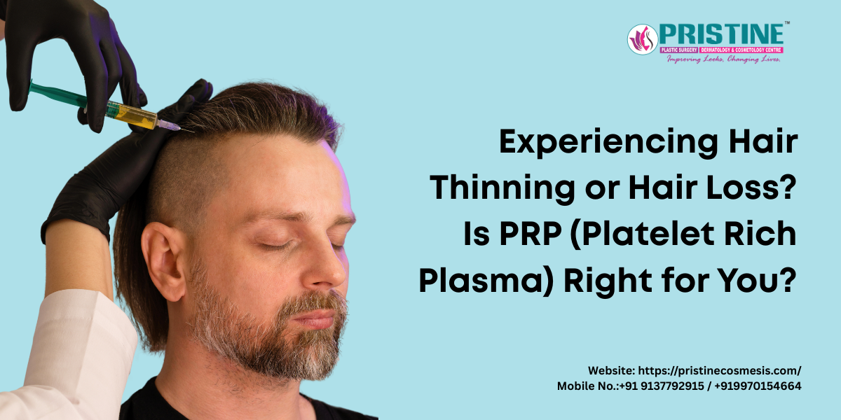 Experiencing Hair Thinning or Hair Loss? Is PRP (Platelet Rich Plasma) Right for You?