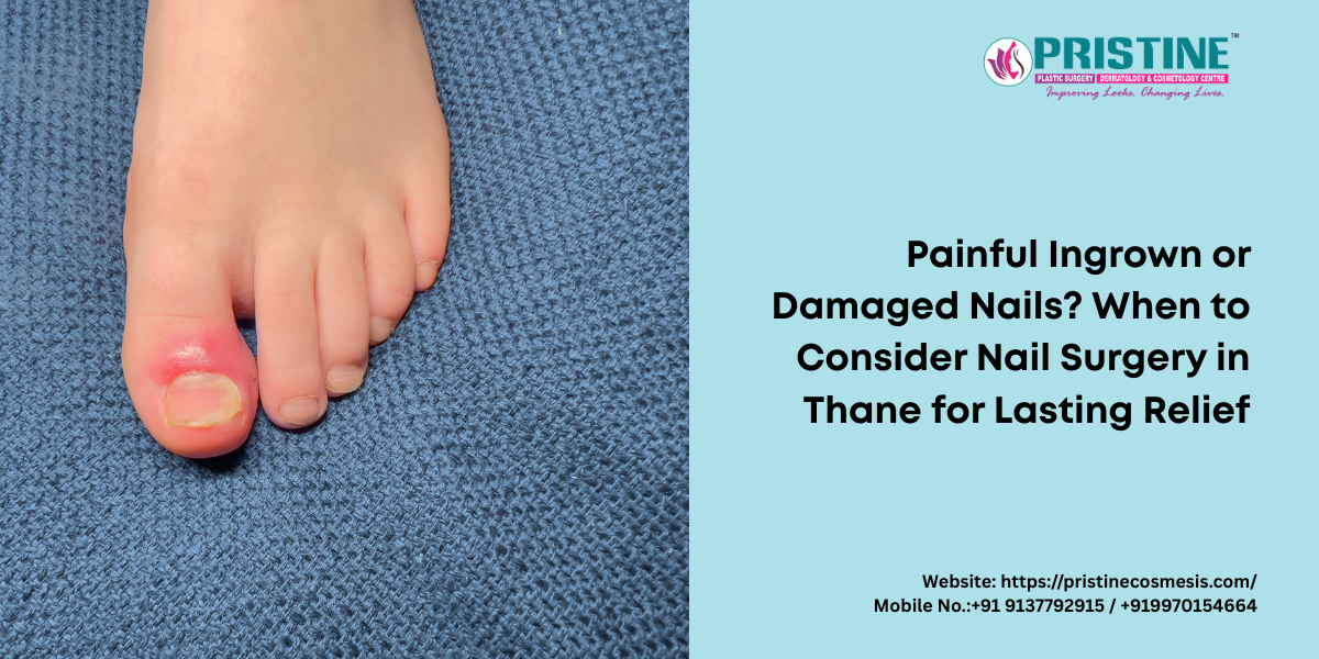 Painful Ingrown or Damaged Nails? When to Consider Nail Surgery in Thane for Lasting Relief