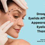 Droopy or Heavy Eyelids Affecting Your Appearance? When Eyelid Surgery in Thane May Help